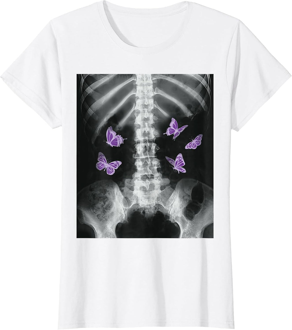 Egirl Xray Skeleton Pink Butterfly Harajuku y2k Dark Grunge T-Shirt - White