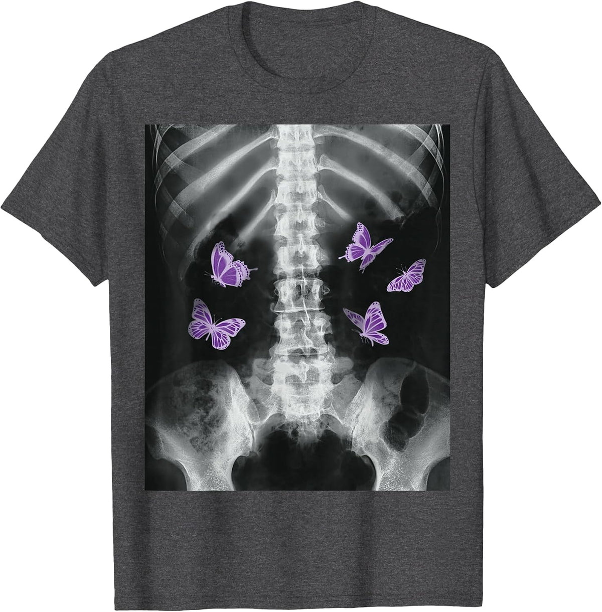 Egirl Xray Skeleton Pink Butterfly Harajuku y2k Dark Grunge T-Shirt - Dark Heather Grey