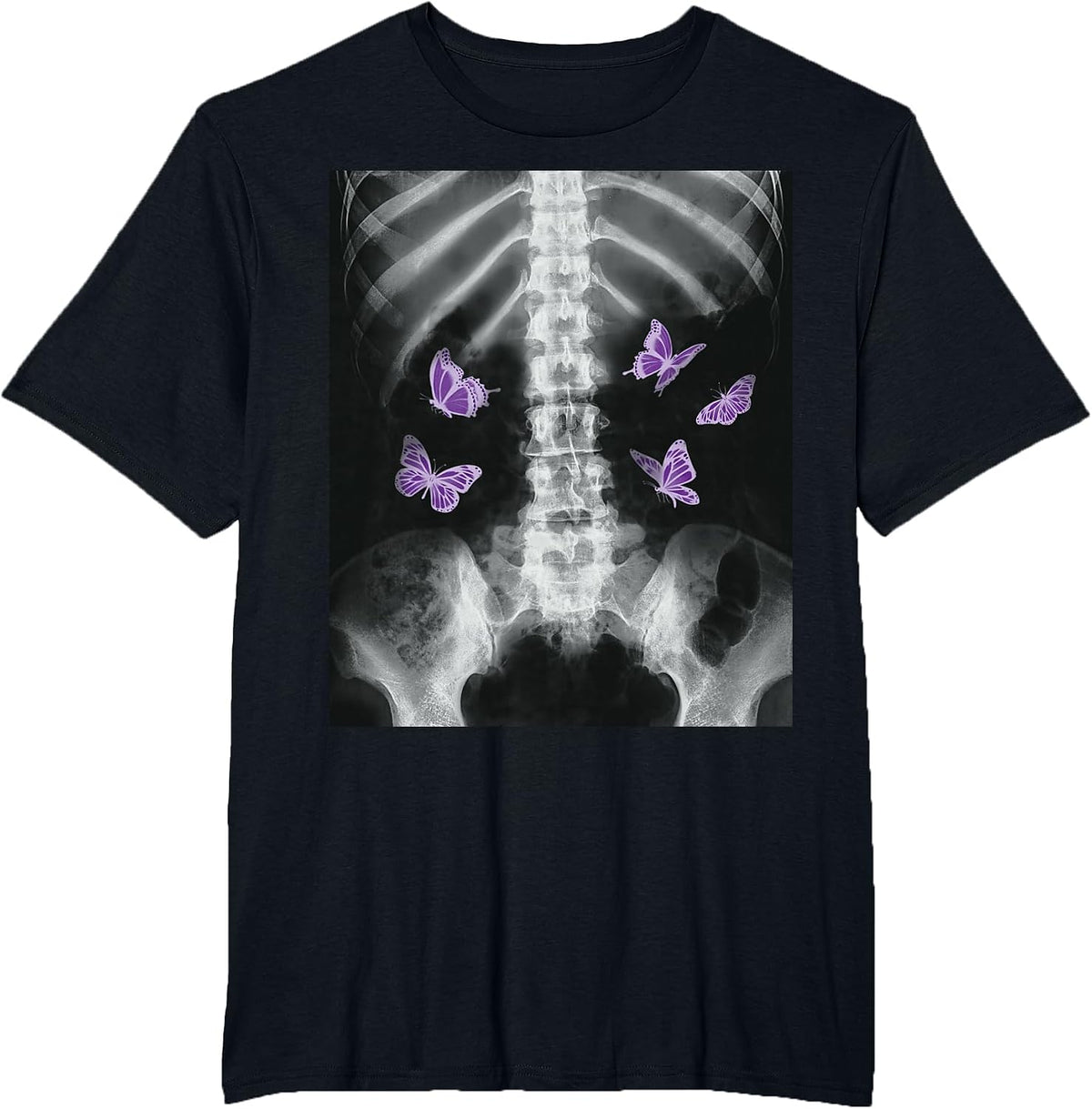 Egirl Xray Skeleton Pink Butterfly Harajuku y2k Dark Grunge T-Shirt - Black